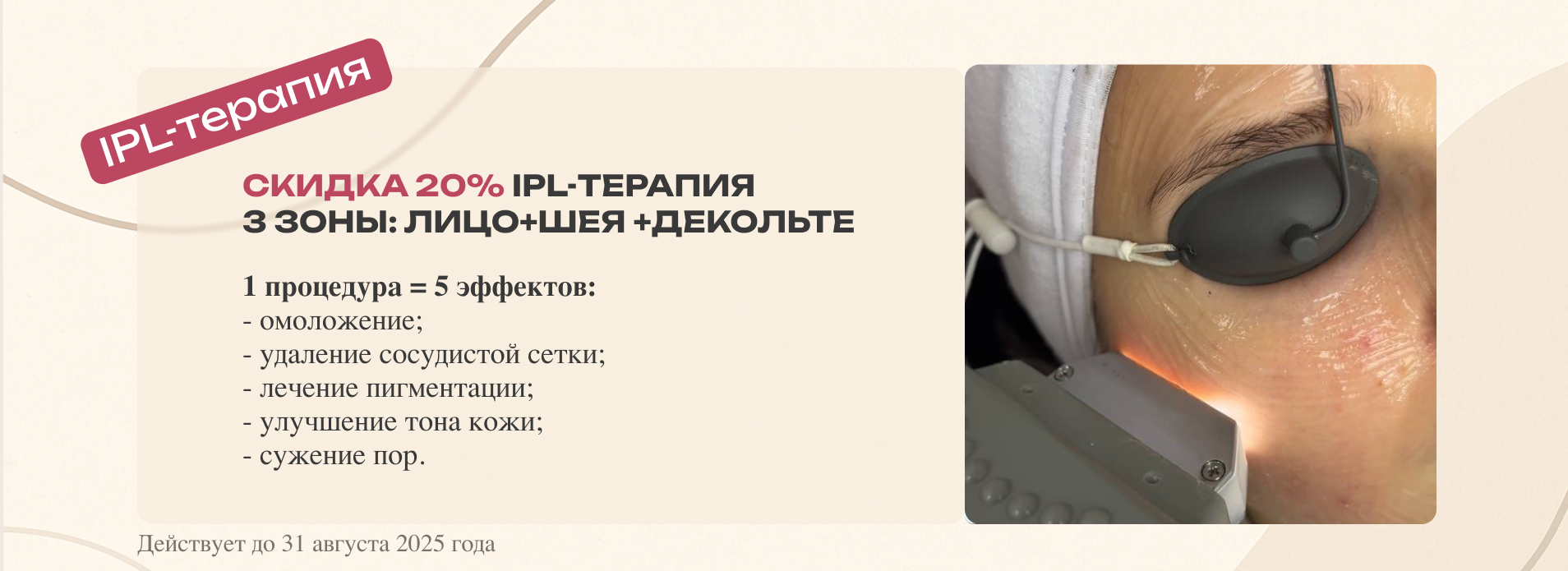 /upload/iblock/8e9/8nbuq86vlvxoille8jp1p5zcepyfqd8r/ipl_terapiya.jpg